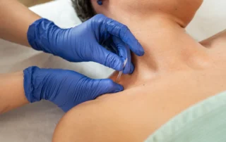 Orthopedic Acupuncture vs Dry Needling Explained
